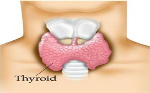 tiroid1.PNG